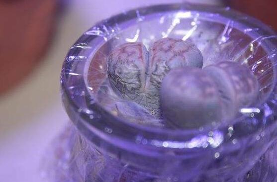 生石花怎麼水培,教你四個基本步驟快速水培生根